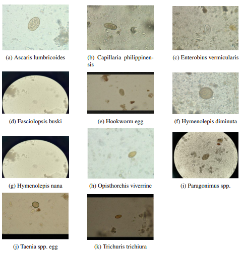 Parasitic Egg Detection and Classification: An Overview of Recent Progress and New Challenges
